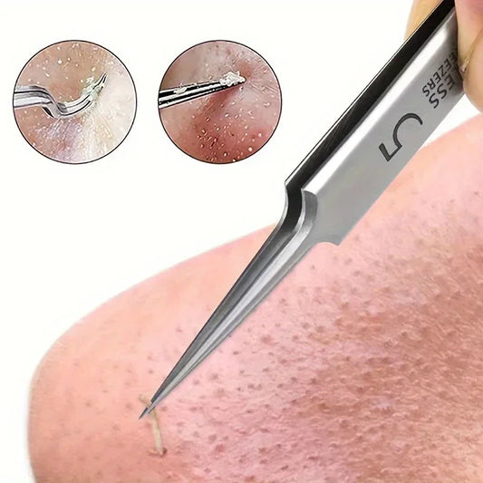 Precision Acne Removal Tweezers™