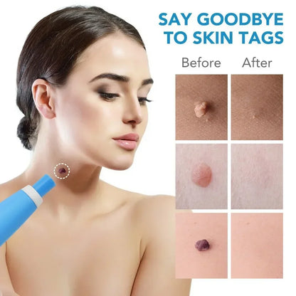Flawless Skin Painless Removal Kit™